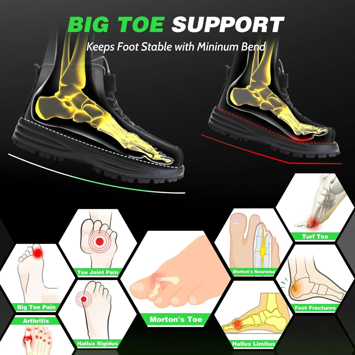 Morton's Extension Orthotic, Carbon Fiber Insole (1 Piece), Rigid Foot Support Insert for Morton's Toe, Foot Fractures, Turf Toe, Hallux Rigidus, and Arthritis, 265(W 10.5-11,M 9.5-10) Black 1pc